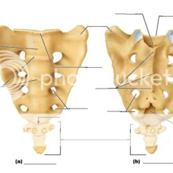 Coccygeal coccyx sacrum sacral hiatus posterior cornua trauma coccydynia transverse imaging rg