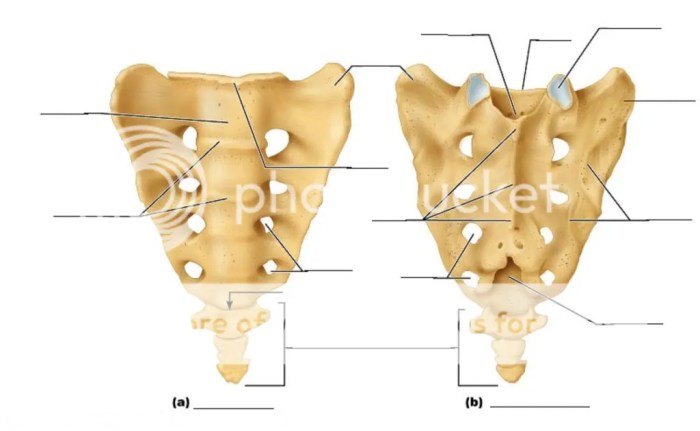 Coccygeal coccyx sacrum sacral hiatus posterior cornua trauma coccydynia transverse imaging rg